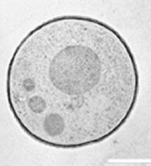 radiotrophic fungus 