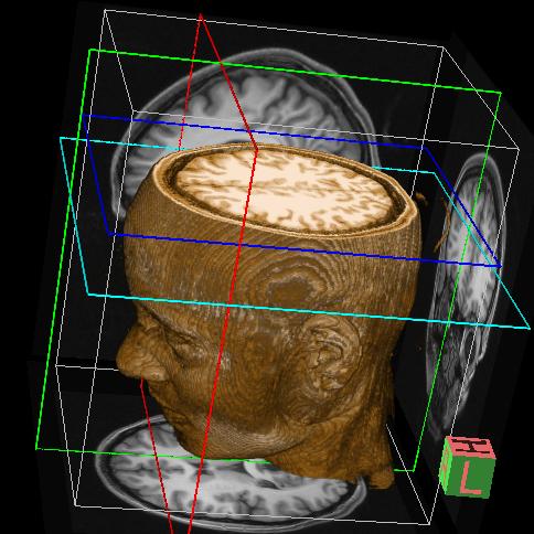 Is Religion Good For Your&nbsp;Brain?