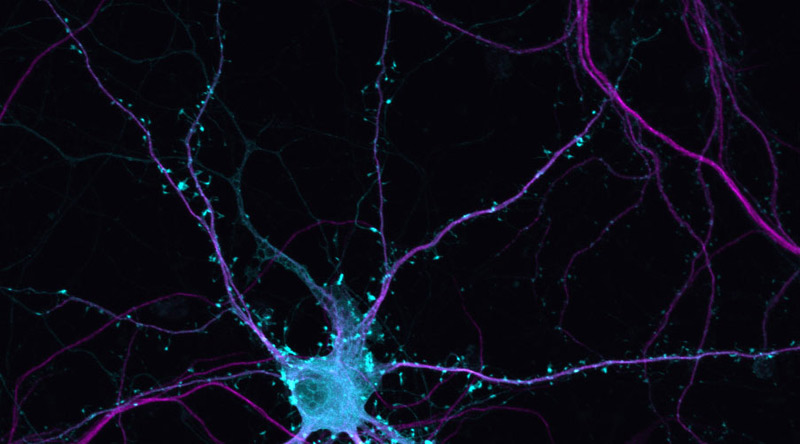 Unprecedented Video of a Neuron Up Close and&nbsp;Personal