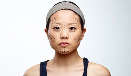 deracialisation surgery