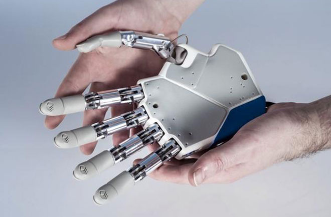 Bionic Hand That Can&nbsp;Feel
