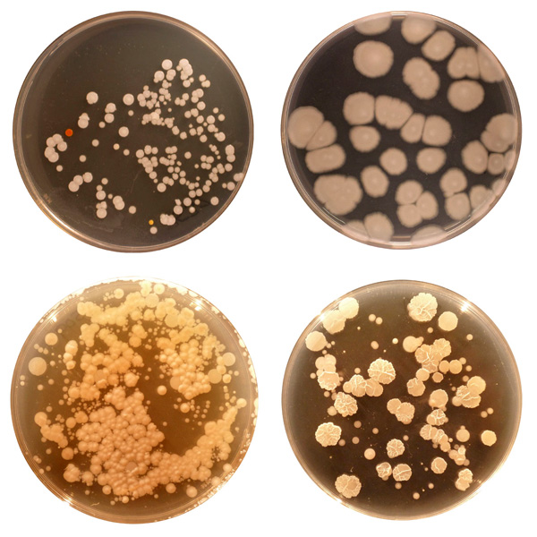 Belly Buttons: Bacteria&nbsp;Wonderland!