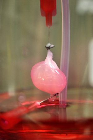 Re-animated Kidneys, 3-D Printing and (Icky?) Organ&nbsp;Markets