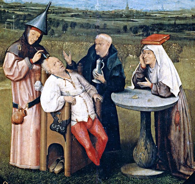 The Fascinating Art of Trepanning: An Ancient Procedure with Modern&nbsp;Potential